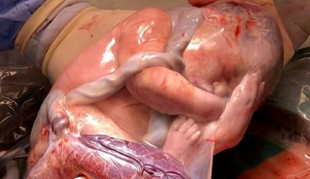 Foto: IG @daddy.twinlife